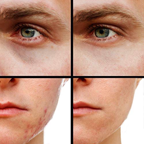 Concealer (Shade 5 of 6) M726